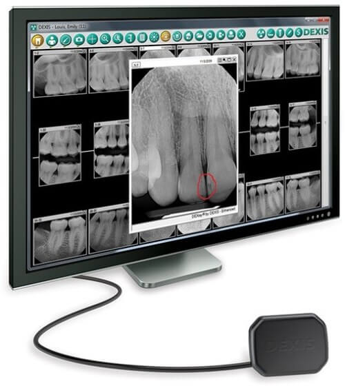 Digital X-rays